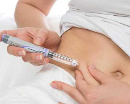 玻璃钢一体化泵站图纸_十年子宫腺肌症，不可以忽视的定期体检