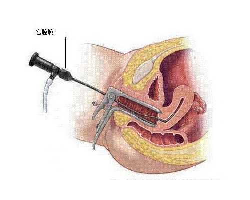 香港医院验血查男女准吗_香港查男女胚囊_验血查男女真的很准吗!