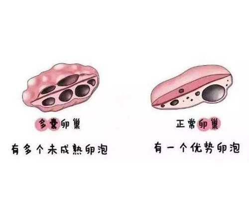 香港6周和七周验血_香港验血测男女安全吗_验血查性别真的靠谱吗!