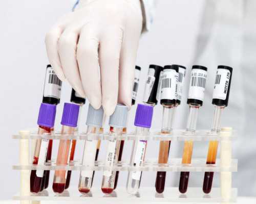 香港验血孕几周最好_香港那么乱还能去验血吗_告诉你详细流程说明!