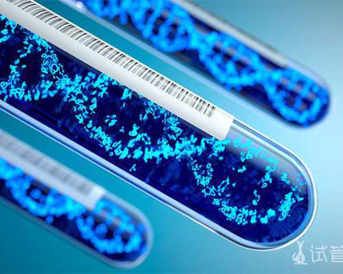 容积泵分类_艺术市场满血复活 艺术青年疲于赶场无心创作