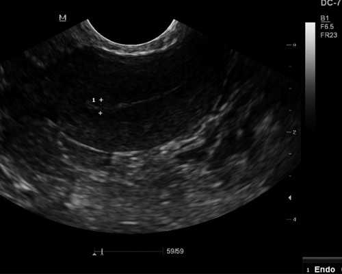 香港验血看男孩女孩准不准_pg香港最新验血报告单准不准_性别鉴定需要什么条
