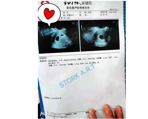 香港验血结果要有几个y_香港最新的验血机构_查男女哪个验血机构比较准