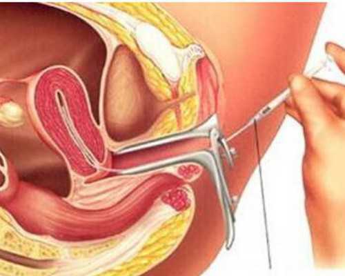 病原体氮泵是什么牌子_落墨乾坤定 长卷传精神——访国家一级书法家丁跟牢