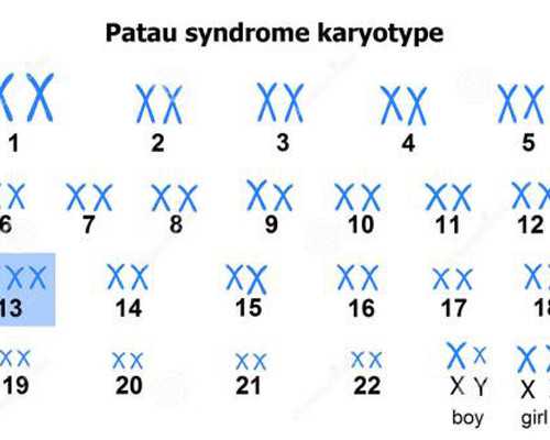 属于容积式的泵有哪些_特朗普政府计划取消美国国家艺术基金会、人文基金会