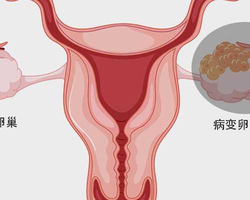 香港公立医院  验血_香港胎儿性别鉴定准不准？我来告诉你香港验血的真相不看