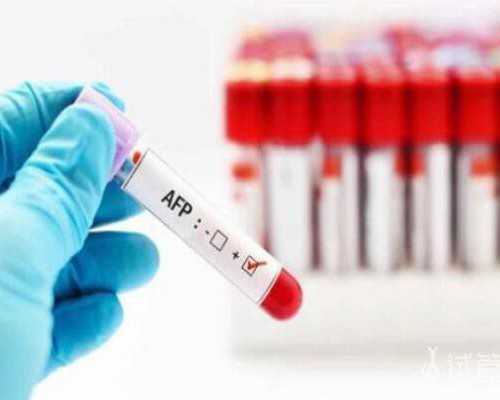 香港几周验血最好_香港验血查男女是查哪个数据_查男女需要什么条件!