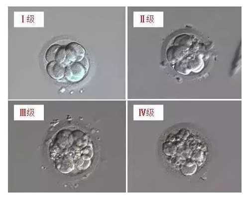胰岛素泵闭环什么意思_小孩发烧腿酸痛是怎么回事
