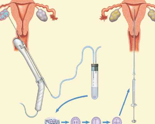 香港时代验血鉴定男女准吗_香港医院验血检测男女的时间_有去香港验血翻盘的