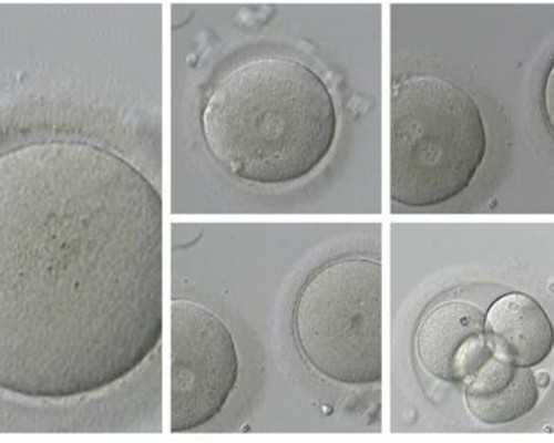 香港验血结果官网查询_香港验血机构哪家好准不准,测性别到底哪家是真的