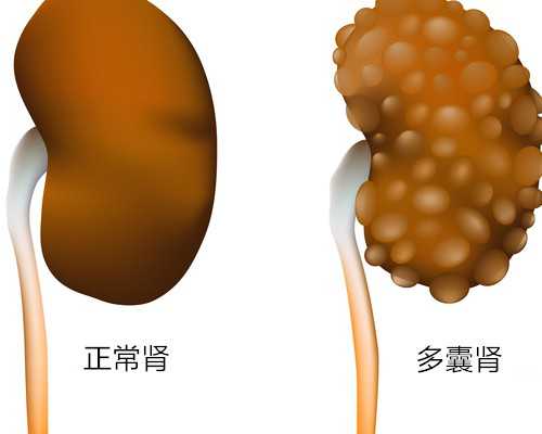 香港验血生下来不准_苏州香港查男女准确率高吗_有没有验血最后翻盘的