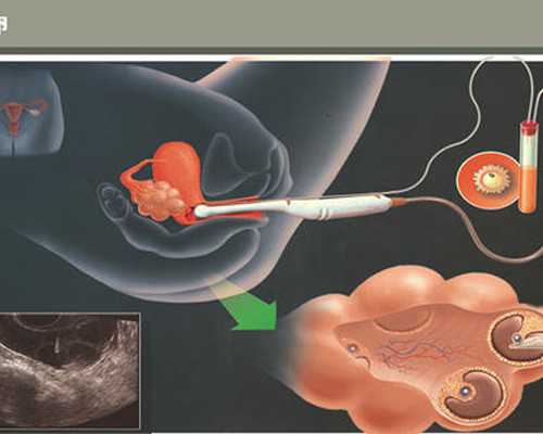 2026香港验血攻略_香港验血成果是儿子胎儿性别几天出能够出成果