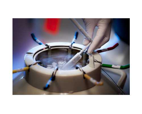 香港迪安亚验血准确吗_香港验血邮寄准吗_验血查男女抽血验孕原理