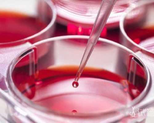 验血报告怎样寄到香港_domain香港验血_有什么需要注意的!