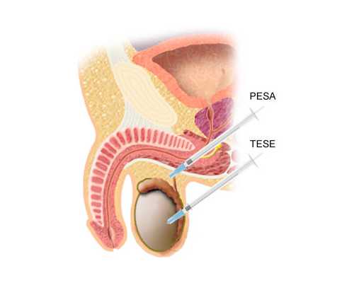 生活污水泵英文_日本东京国立博物馆纪念品“陶俑袜”热销