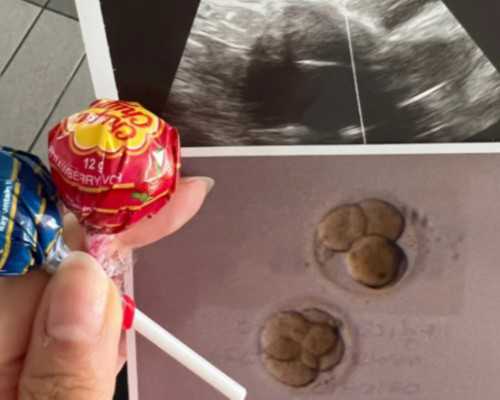 香港验血结果出来快吗_香港验血男孩女孩要多少天?亲身经历告诉你