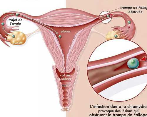 注射泵压力限制H是什么意思_家常酸菜鱼做法