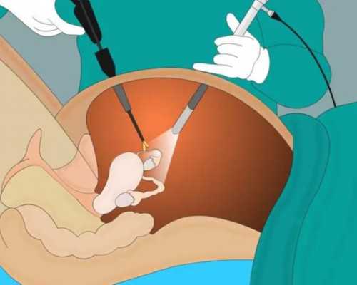 香港 美亚 邮寄验血_香港验血要准备什么_验血查男女需要什么流程