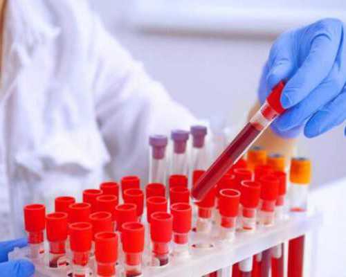 香港验血鉴定男女准吗有错过吗_香港验血男女化验所_选择哪家化验所好