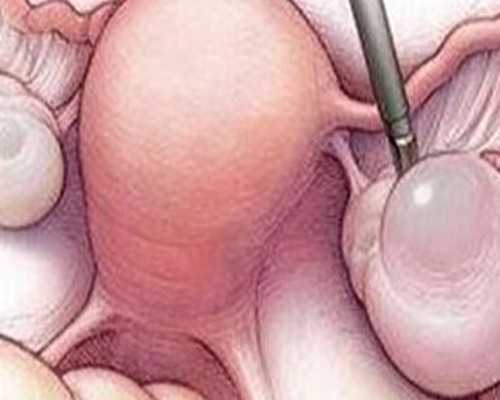 美国flowserve泵公司_六种办法让你每天都减重