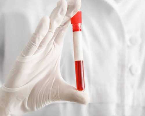 香港验血查男女的标准胚胎数据_香港验血查性别价格_本人亲身经历告诉你!