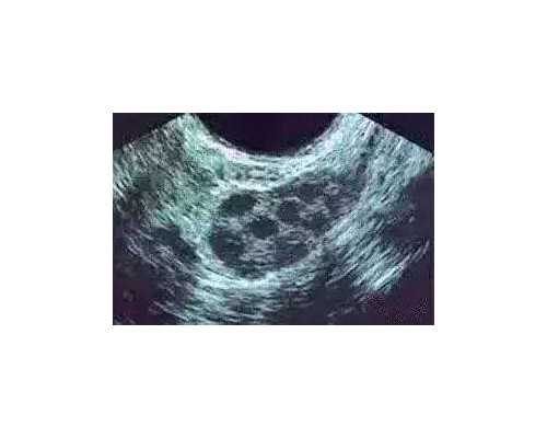 香港邮寄验血女孩_香港验血老牌机构准不准,验血查男女是不是骗人的