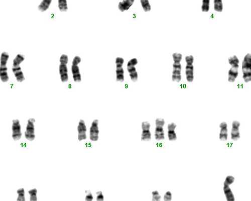 香港验血鉴定男女需要准备些什么_香港验血什么医院好_验血女却生了男孩是真