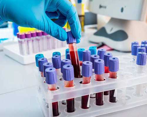 香港7周验血是女孩重验_香港验血地中海贫血_有什么需要注意的