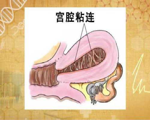 注射泵品牌排行_想象力才是绘画创作之根本