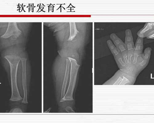 怀孕多长时间可以香港验血_怀孕6周多香港验血可信吗?分享一下本人亲身经历