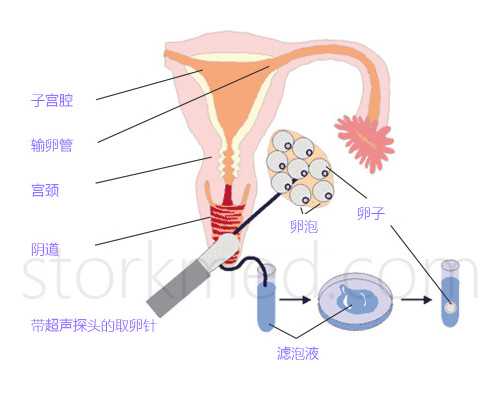 香港验血邮寄去哪里抽血_怎么看香港验血的报告单准不准_验血查男女准不准
