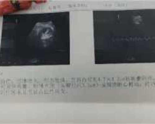 邮寄香港验血都是去哪抽血的_1000字作文，从此我不再……人生规划1000字作文