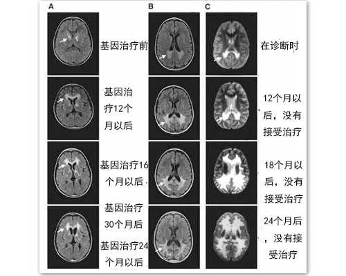 镇痛泵的种类图片_广东时代美术馆将关停展厅项目