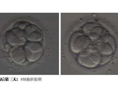 香港验血官网可以查询_香港验血鉴定男女准还是b超准,哪家诊所准确率最高?