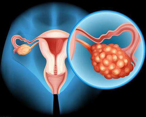 怀孕初期香港验血_预知宝宝男女：你是否契合去香港验血条件？