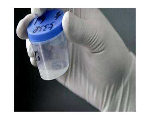 香港验血精准报告查询_香港dna验血几天出报告单_验血翻盘女翻男吗!