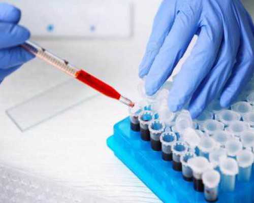 香港博爱医院能验血吗_香港达雅高验血报告单_哪家化验所最权威你知道吗!