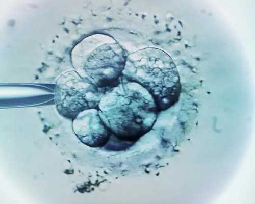 香港亚太妇产验血准吗_验血验男女准_验血查男女有科学依据吗