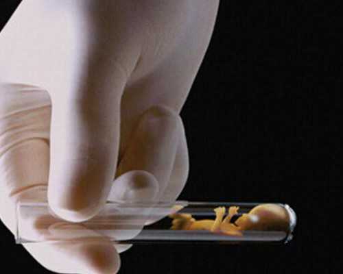 香港验血邮寄 林顾问_香港查男女权威机构_检测到有Y染色体却生的女孩!