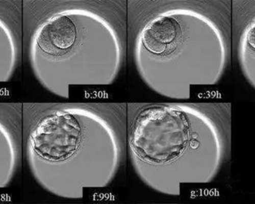 镇痛泵分类_天冷食欲强如何控制自己的食欲