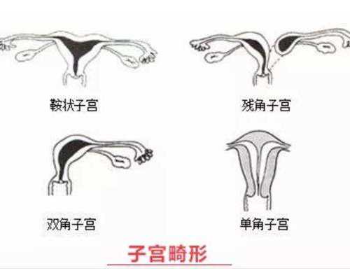 香港孕妇验血哪家好_香港验血价格才200元靠潜吗?分享一下本人亲身经历