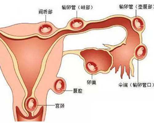 多囊怀孕香港验血_香港验血让从新验什么意思_鉴定性别是真还是假