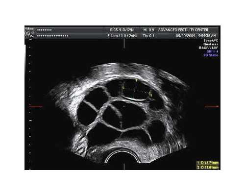 只有胎心香港验血准吗_怀孕香港多久能验出男女_验血查男女哪个诊所准!