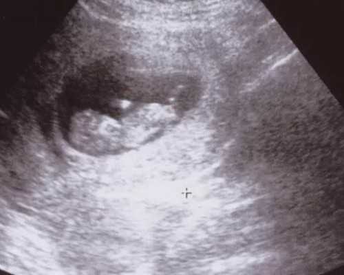 香港邮寄血样验血_香港验血要求mkm机构_验血查男女要几周看完你还做吗!