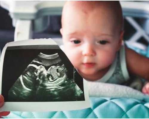 香港验血结果不会看_验血检查男女_验血查男女哪机构个最准