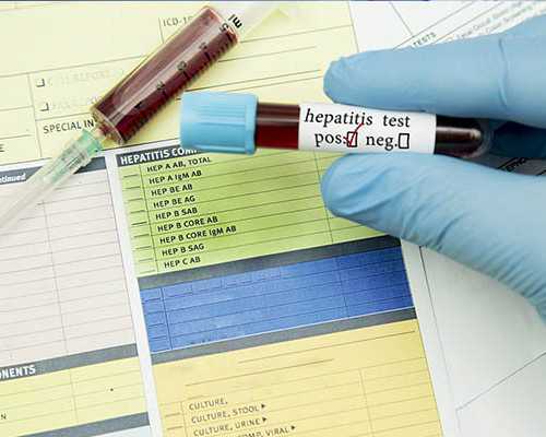 香港验血超过7周可以做吗_香港验血怎么检查胎芽,测男女结果有可能翻盘吗