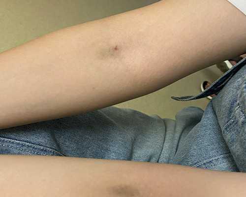 香港验血怎么找靠谱的诊所_《假文盲》看图作文！谢了怎样写好看图作文步骤