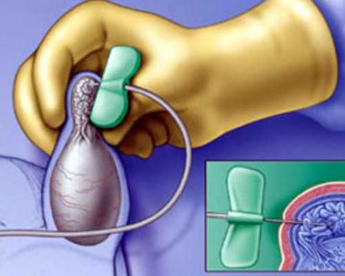 无阀柱塞泵_中国当代艺术的启示:眼睛与思想