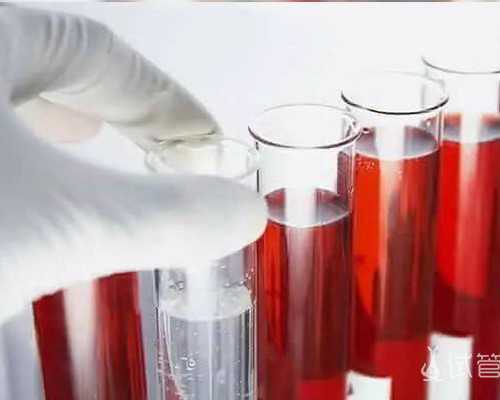 香港验血的血可以放几天_香港嘉宾中心楼验血_验血查性别准不准