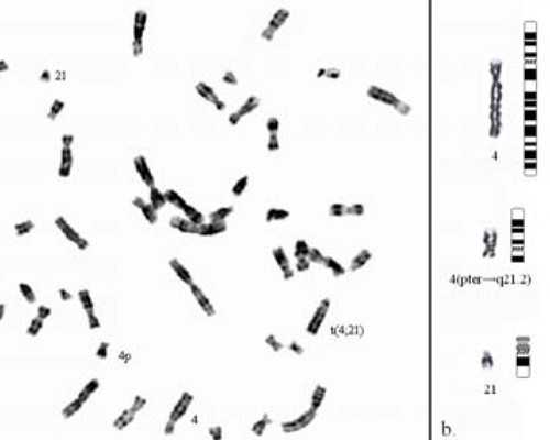 生化后去香港验血准吗_香港验血男女要多少钱_查性别真的准确吗